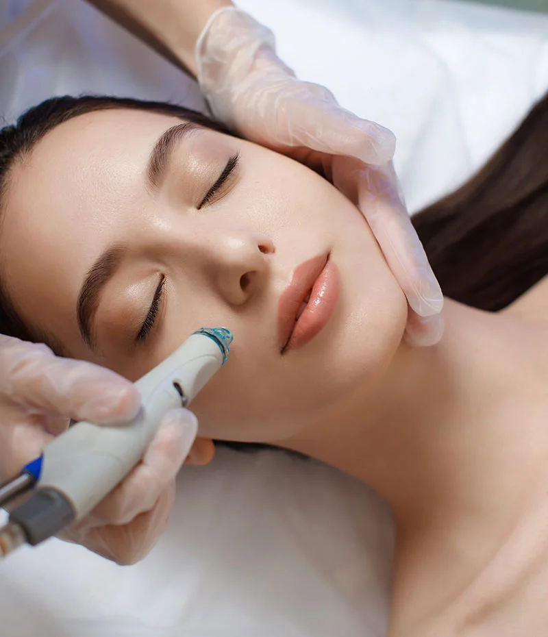 Woman receiving Hydrafacial treatment on her cheek