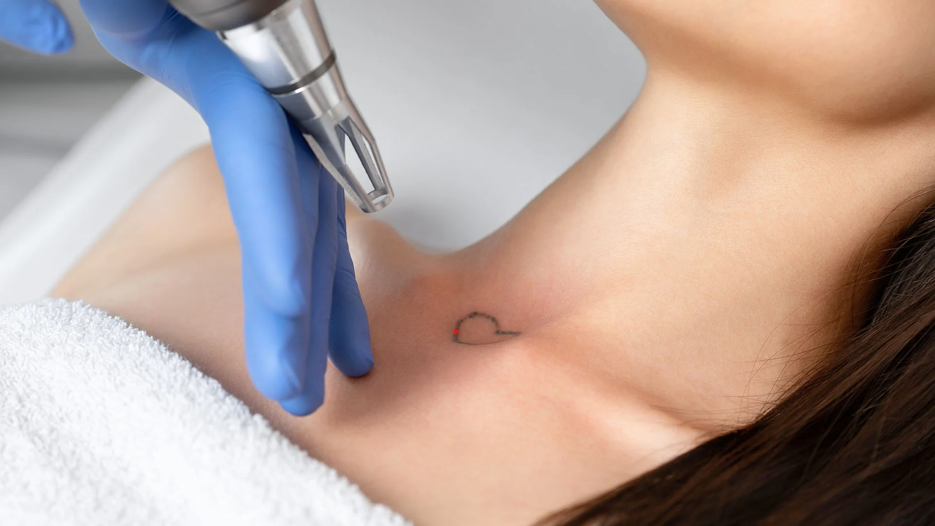 Laser Tattoo Removal Atlanta & Fayetteville | Skin Care 5th Ave.