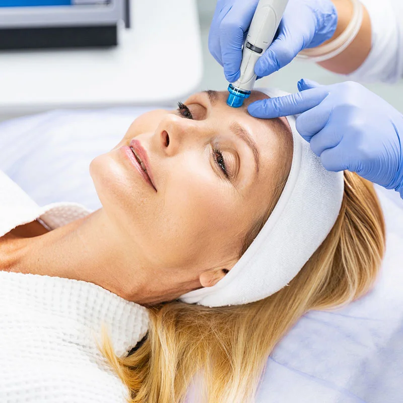 Microdermabrasion procedure on woman's eyebrow and forehead