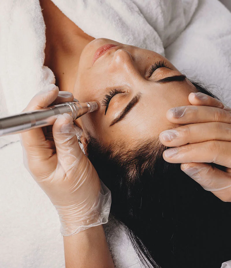 Woman receiving Microdermabrasion on her under eye and cheeks