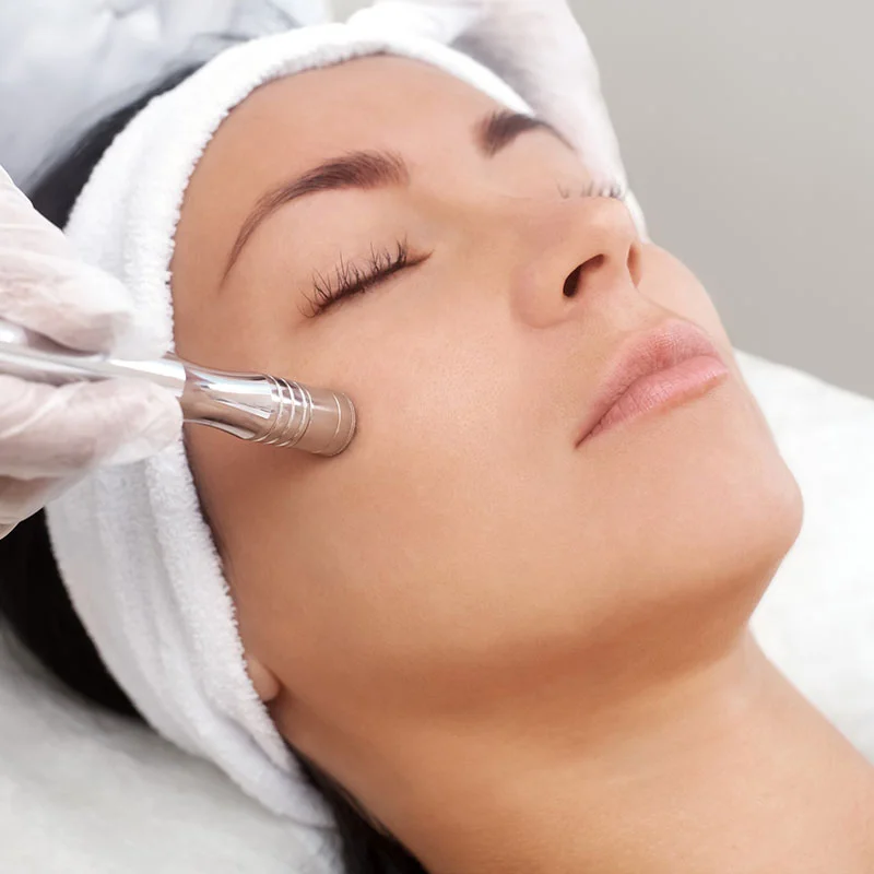 Microneedling procedure on woman's face